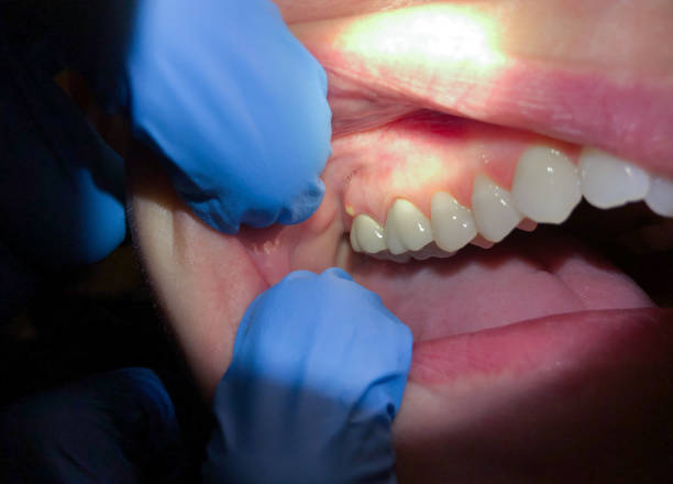 Best Emergency Treatment for Jaw Pain or Injury in Cedar Grove, FL