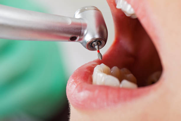 Best Emergency Treatment for Oral Infections in Cedar Grove, FL